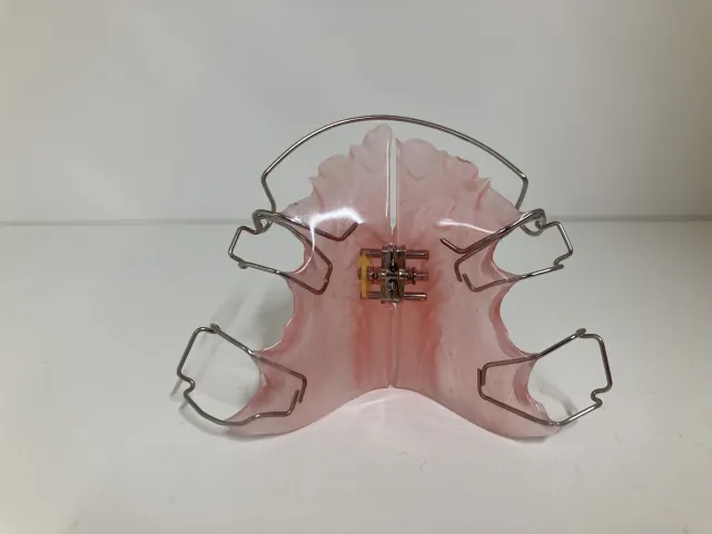 子どもの矯正（床矯正）